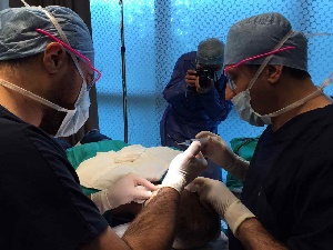 Haartransplantatie aanbieding